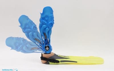 Creating a one-of-a-kind prosthesis with Artec Eva and Geomagic Freeform